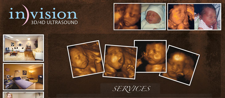 Invision Ultrasound Project